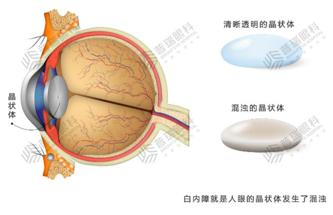 眼底病科是什么意思