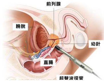 女性咽喉癌的早期症状图片