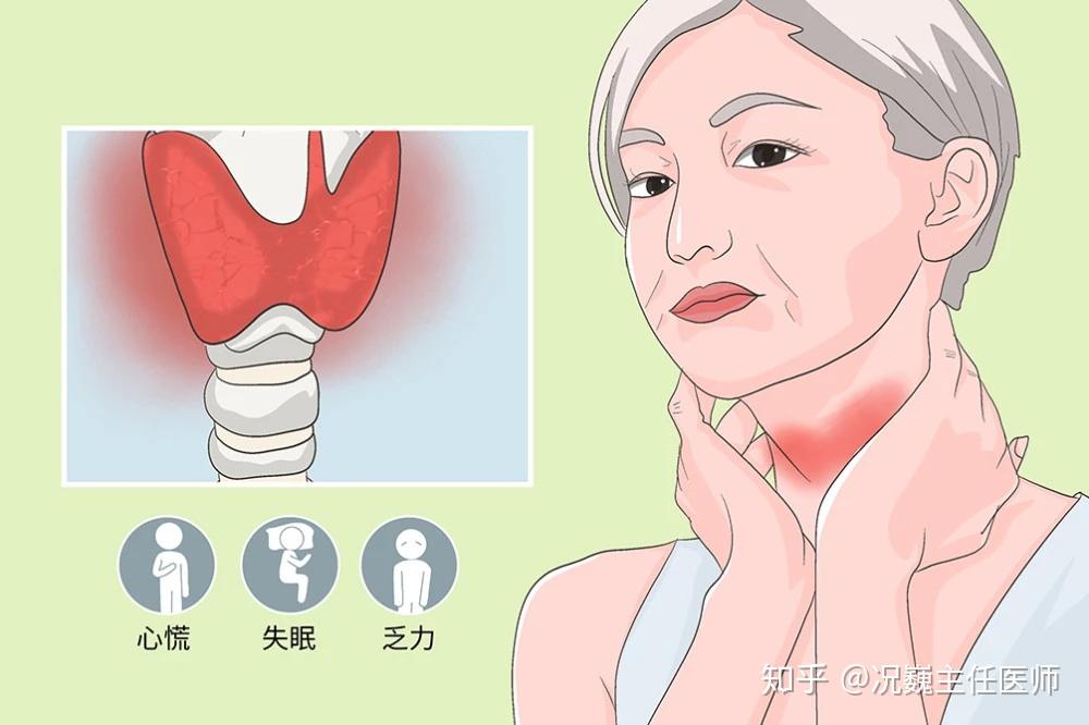 甲亢甲状腺结节怎么治疗最好