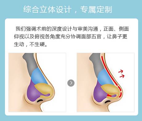 牙周炎多少钱